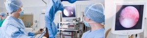 endoscopy